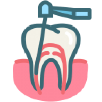 Root Canal